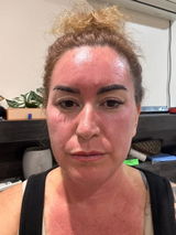 Anonymous review photo