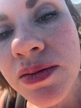 Anonymous review photo