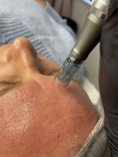 Dr. Pen M8 Ultima Microneedling Pen