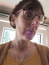 Anonym review photo