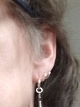 Anonym review photo