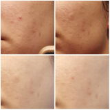 Lauren review photo