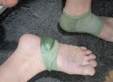 Anon review photo