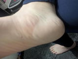 Anon review photo