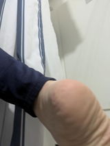Anon review photo