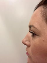 Melinda review photo