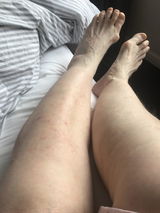 Anonymous review photo