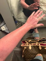 Anonymous review photo