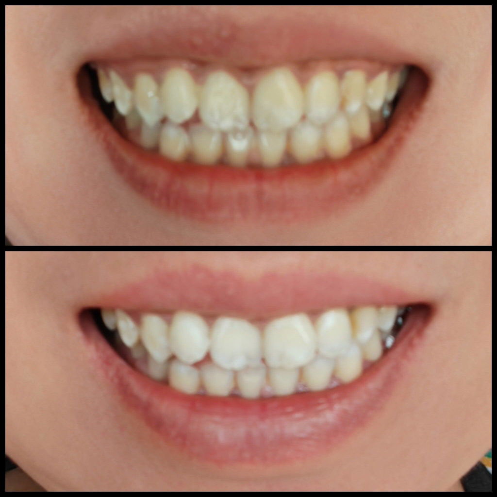 Probiotic Whitening Toothpowder