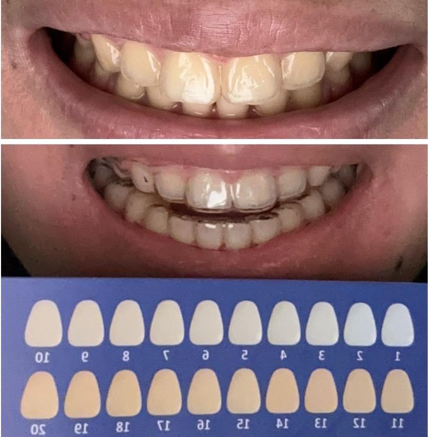 Probiotic Whitening Toothpowder