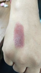Anonymous review photo