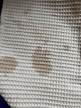 Anonymní review photo
