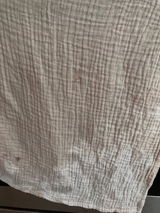 Anonymní review photo
