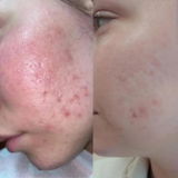 Noor review photo