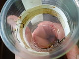 Randall Younger review photo