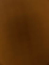 Anonym review photo