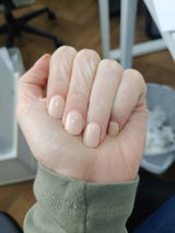 טל נ. review photo