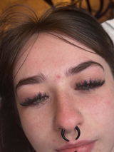 @Skinbyalche review photo