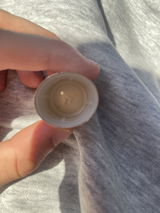 Anonym review photo