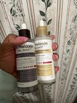 Amazon Customer review photo