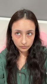 Aleliamh review photo