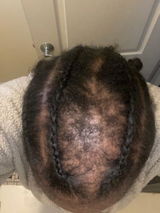 Arosemond G. review photo