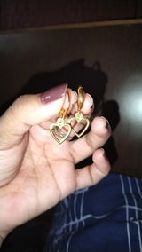 Anonymous review photo