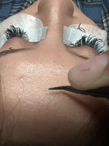 Anonymous review photo