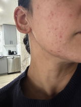 Anonymous review photo