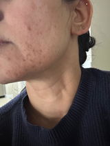 Anonymous review photo