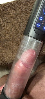 Anonymous review photo