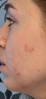 Anonyme review photo