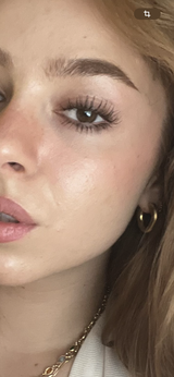 Anonyme review photo