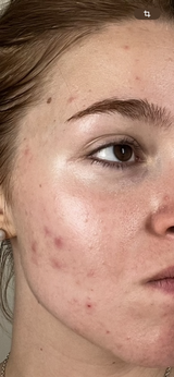 Anonyme review photo