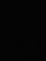 Anonym review photo