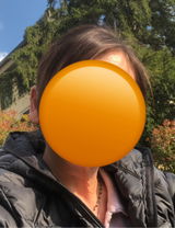 Stefygo review photo