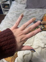 Anonymous review photo