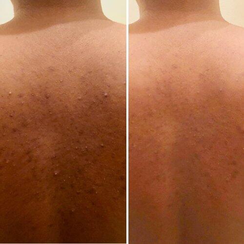 Le Gant Exfoliant Kessa