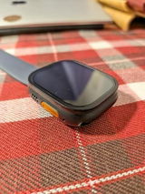 Amazon カスタマー review photo