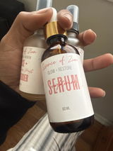 a B review photo