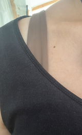 Anonymous review photo