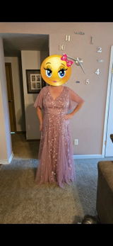 Anonymous review photo