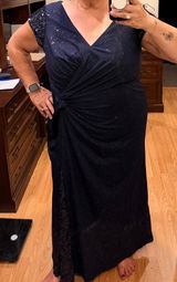 Anonymous review photo
