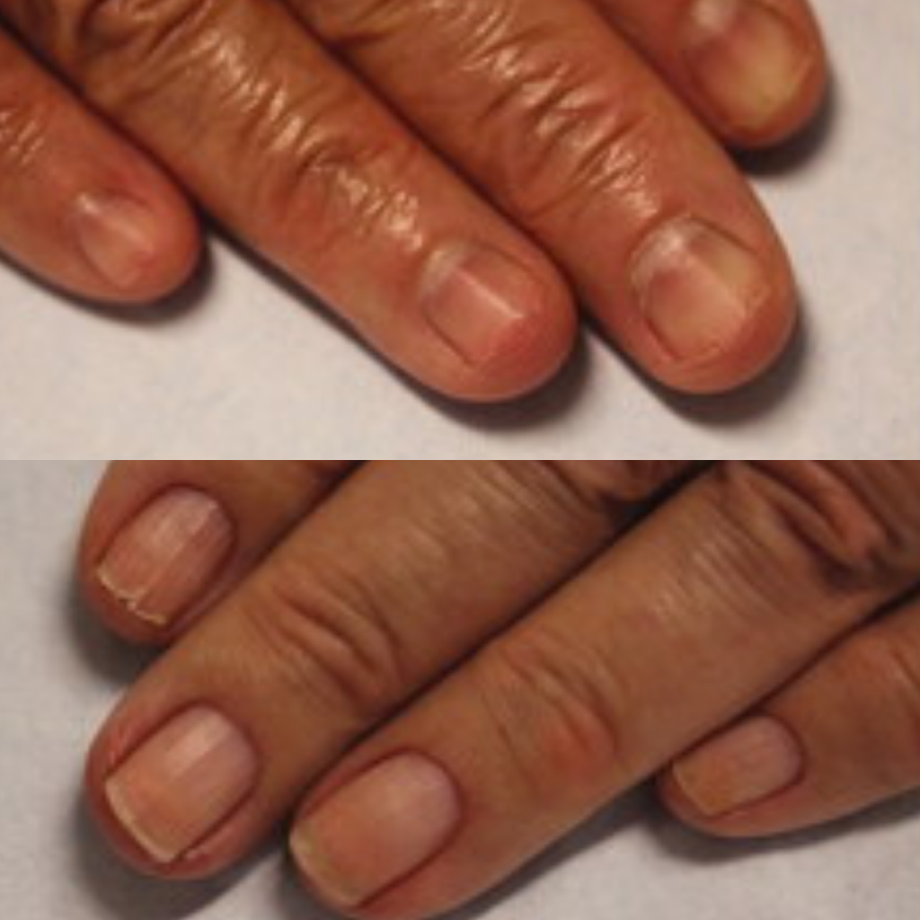 NailRevive Prime Nail Serum with DualPeptide Formula™
