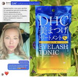 Instagram review photo