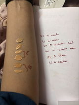 Anonymous review photo