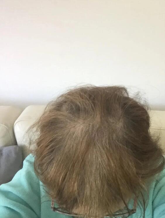 Customer review photo