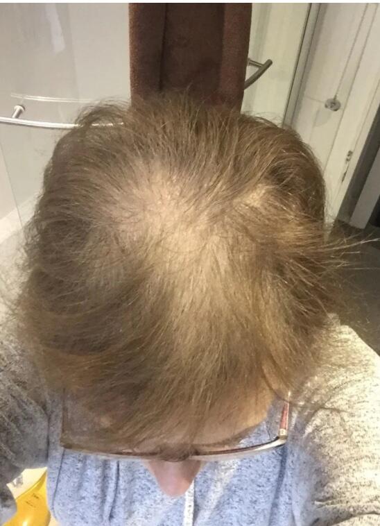 Customer review photo