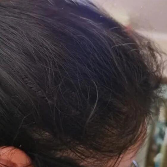 Customer review photo