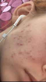 Customer review photo